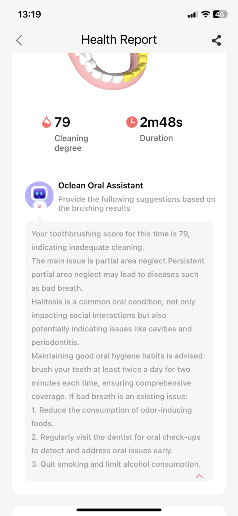 Oclean X Ultra S szónikus fogkefe teszt 31