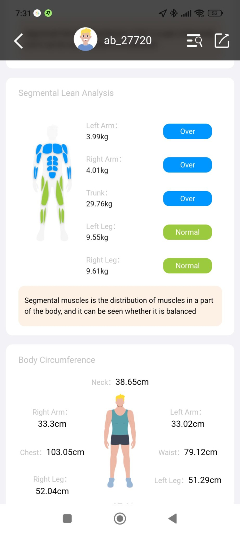 BodyPedia LM-S001 testösszetétel elemző okosmérleg teszt 23